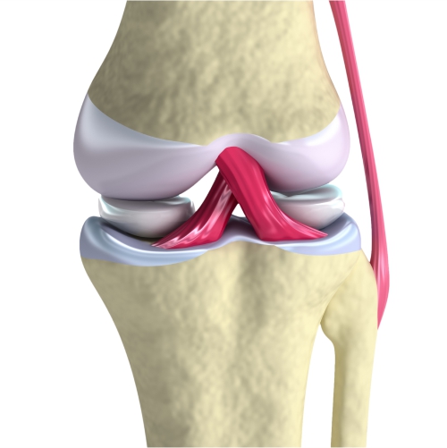 Implantes de Cartilagem